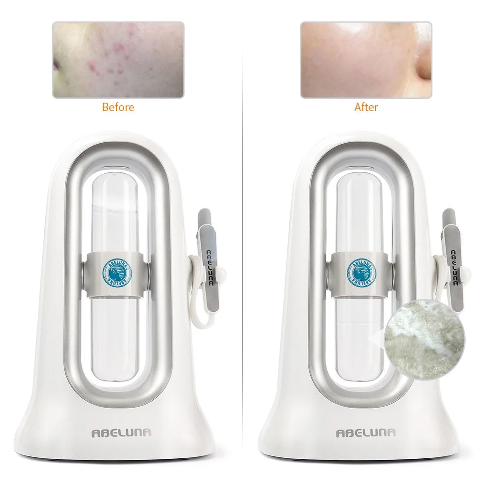 Hidrafacial profesional